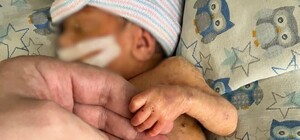 В Одесской области спасли родившегося на 29-й неделе малыша