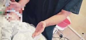 В Одессе сделали уникальную операцию на сердце шестимесячному мальчику